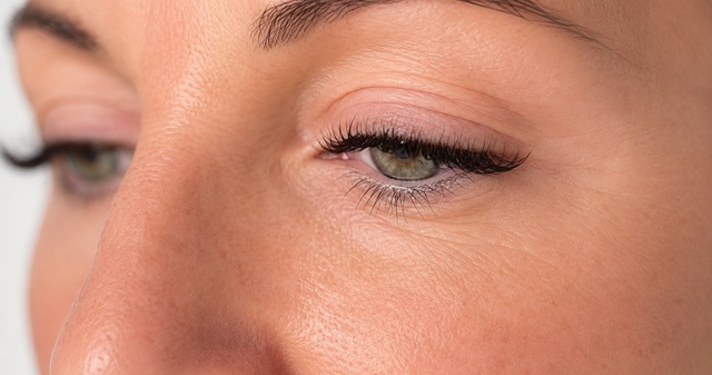 Client's under-eye area after Lumi-PN Eyes treatment at Portland Body Clinic