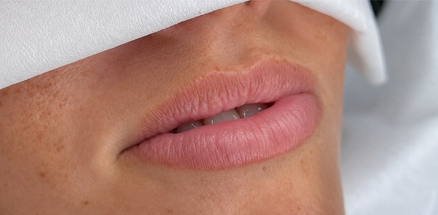 Client's lips before LUMI-PRO Lips treatment at Portland Body Clinic